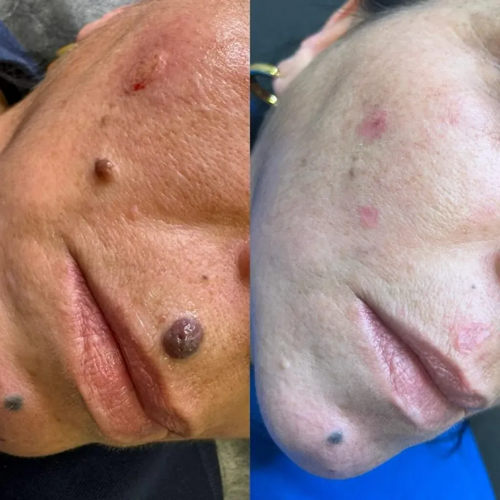 dermaplax almeria