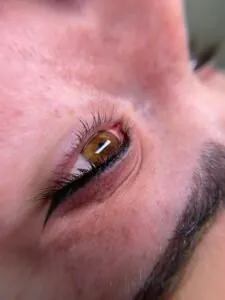 raya del ojo en roquetas
